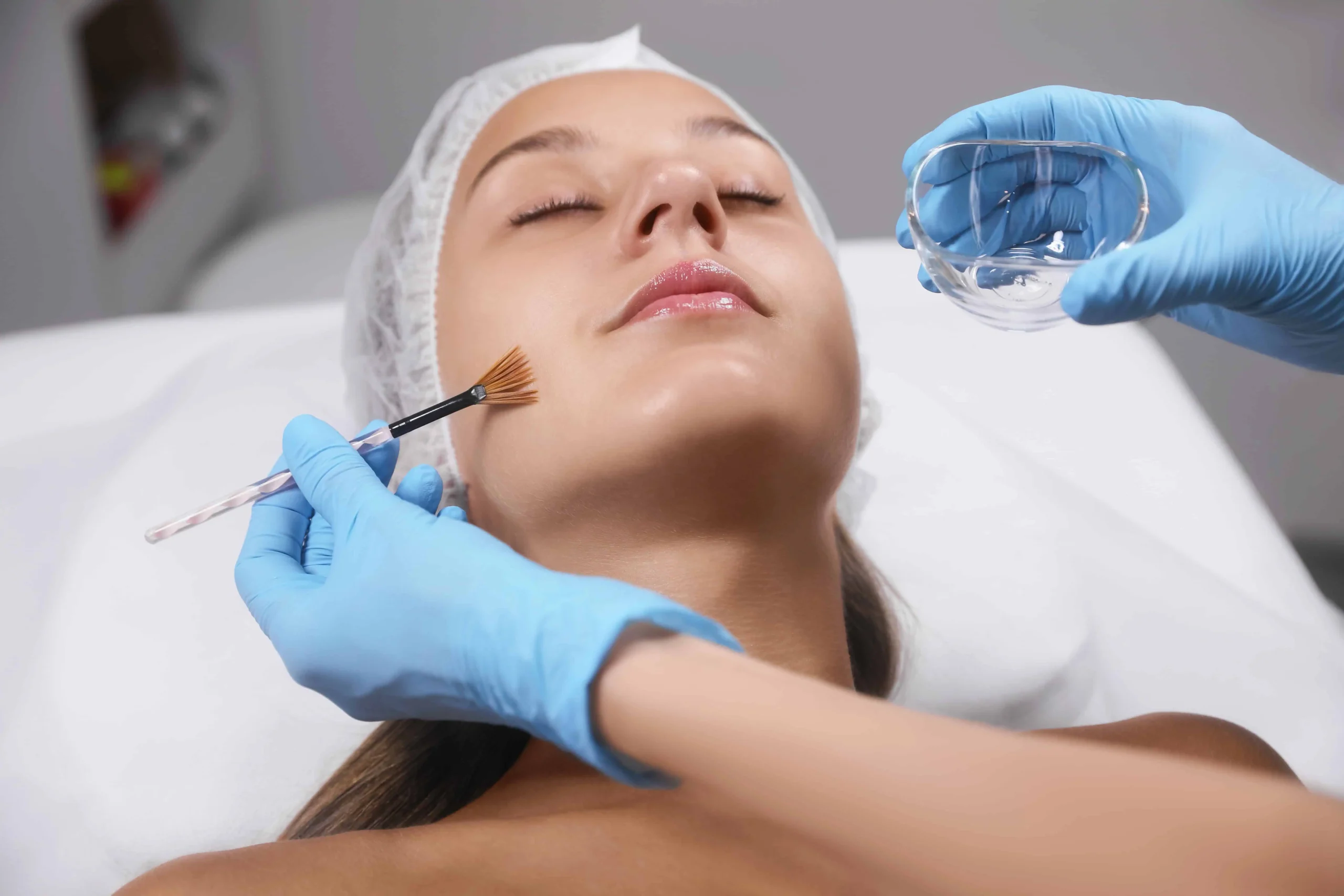 Provider in medical gloves applying VI Peel solution to a woman's face with a brush at a med spa in Old Bridge, NJ.