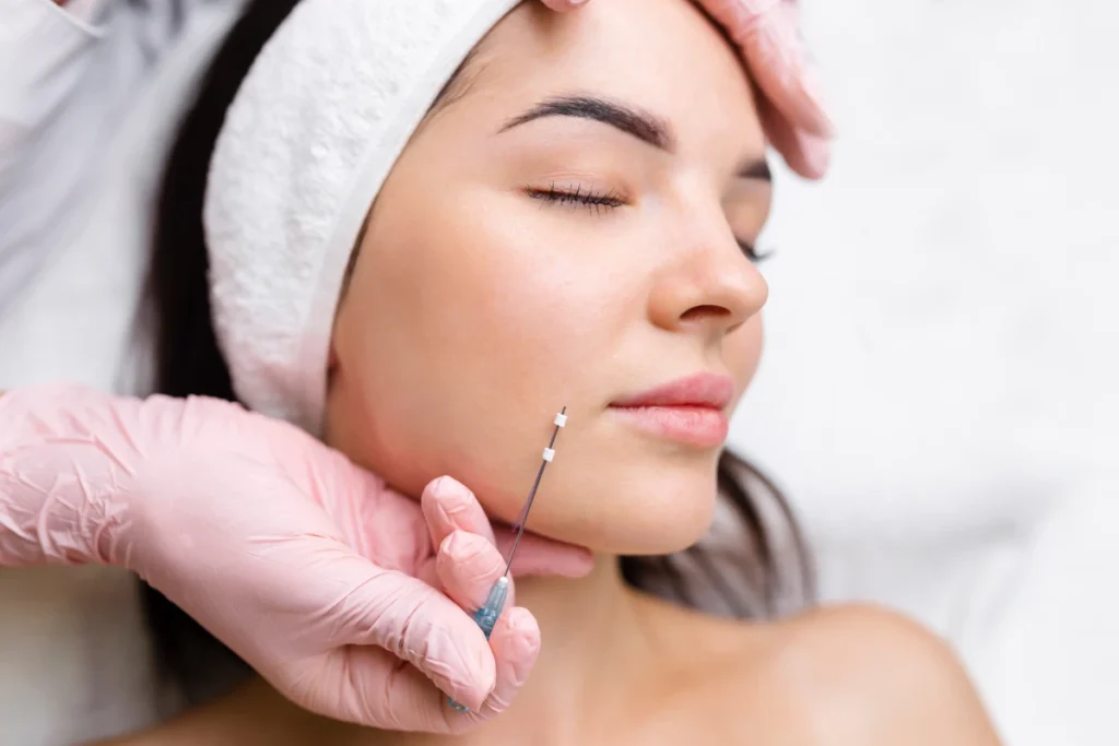 PDO Thread Lift treatment for early sagging skin and facial tightening